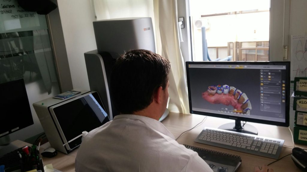 cad-cam