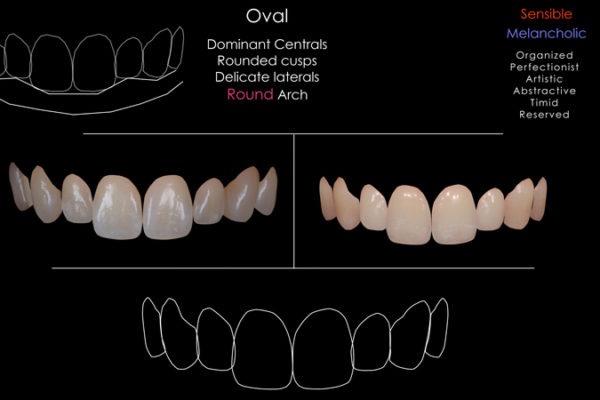 digital-smile-design