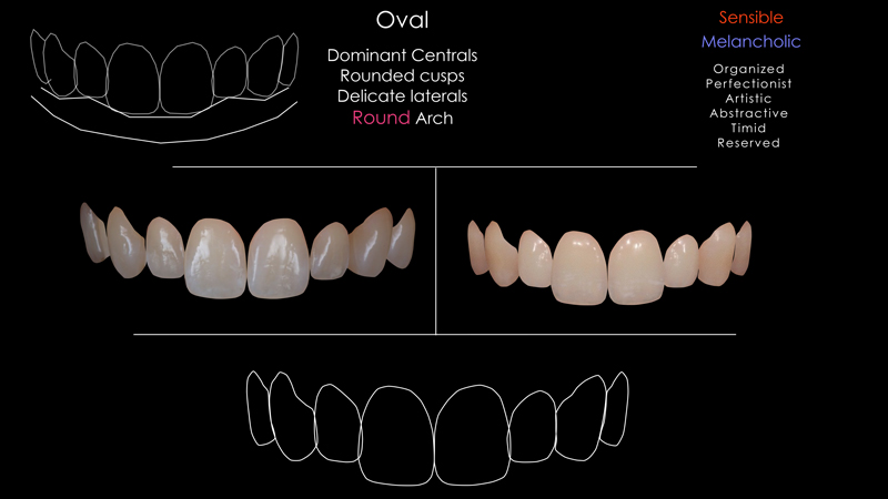 digital-smile-design