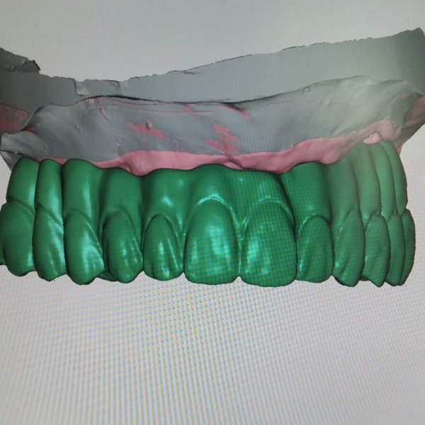 BioHPP-Inyección-Composite