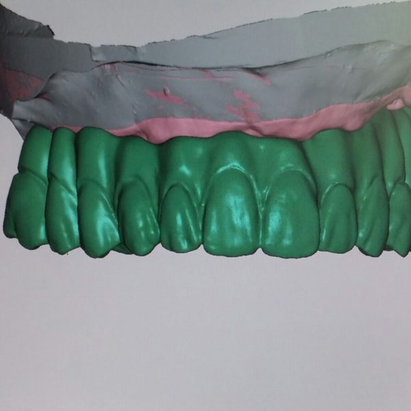 BioHPP-Inyección-Composite