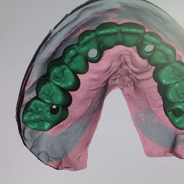 BioHPP-Inyección-Composite