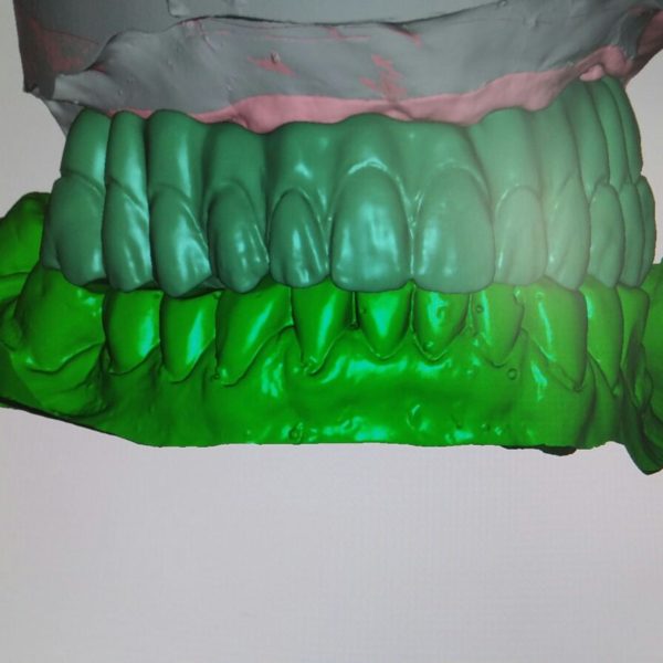 BioHPP-Inyección-Composite