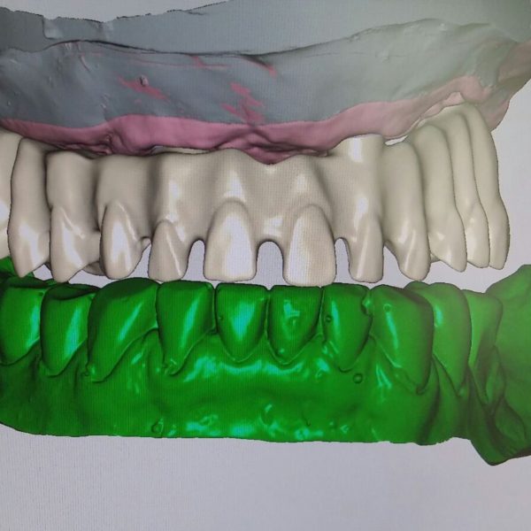 BioHPP-Inyección-Composite