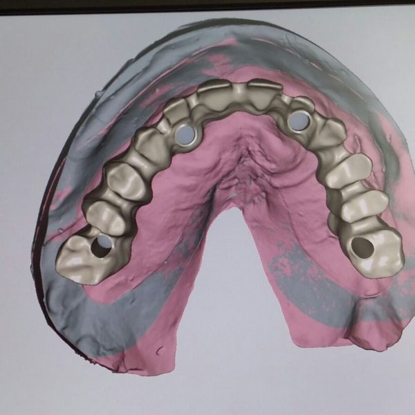 BioHPP-Inyección-Composite