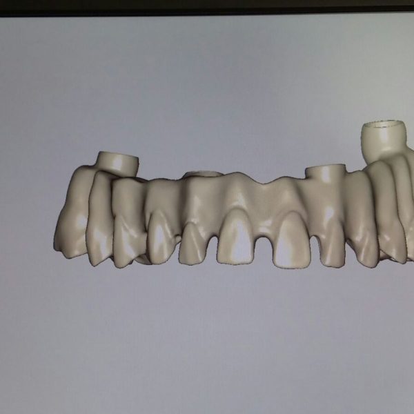 BioHPP-Inyección-Composite