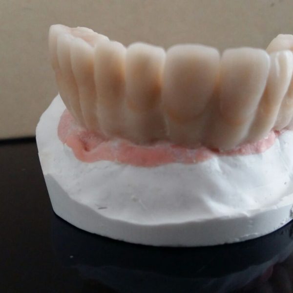 BioHPP-Inyección-Composite