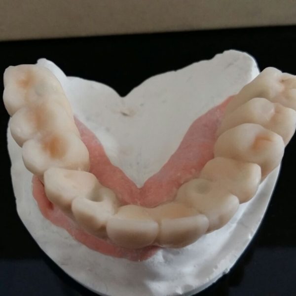 BioHPP-Inyección-Composite