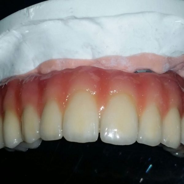 BioHPP-Inyección-Composite