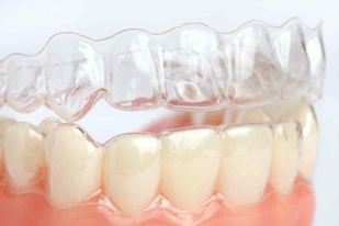 Ferulas de descarga blandas o duras… ¿vale la pena la promoción? – Doctor  Chavez. Dentista en Barcelona.