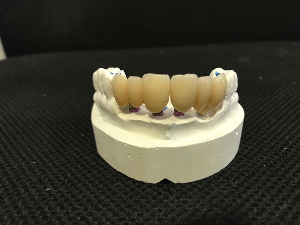 ceramica-dental-zirconio