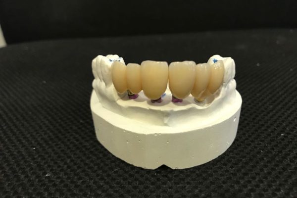 ceramica-dental-zirconio