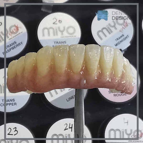 Supra estructura de zirconio maquillada con técnica miyo